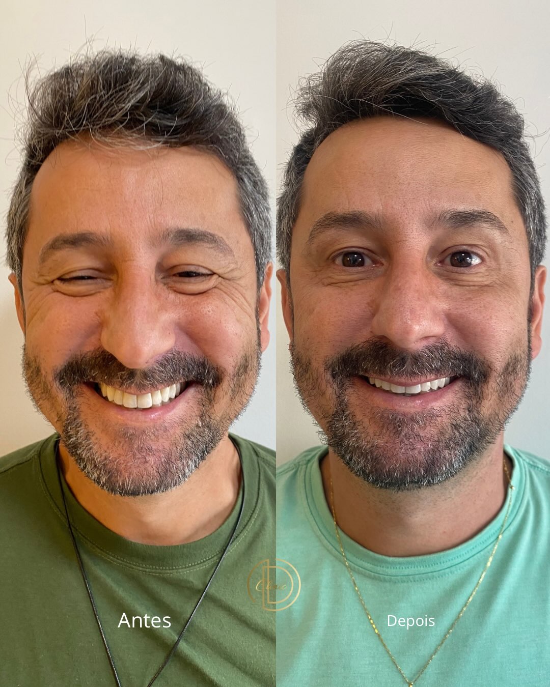 Antes e depois de paciente da Dra. Daniele