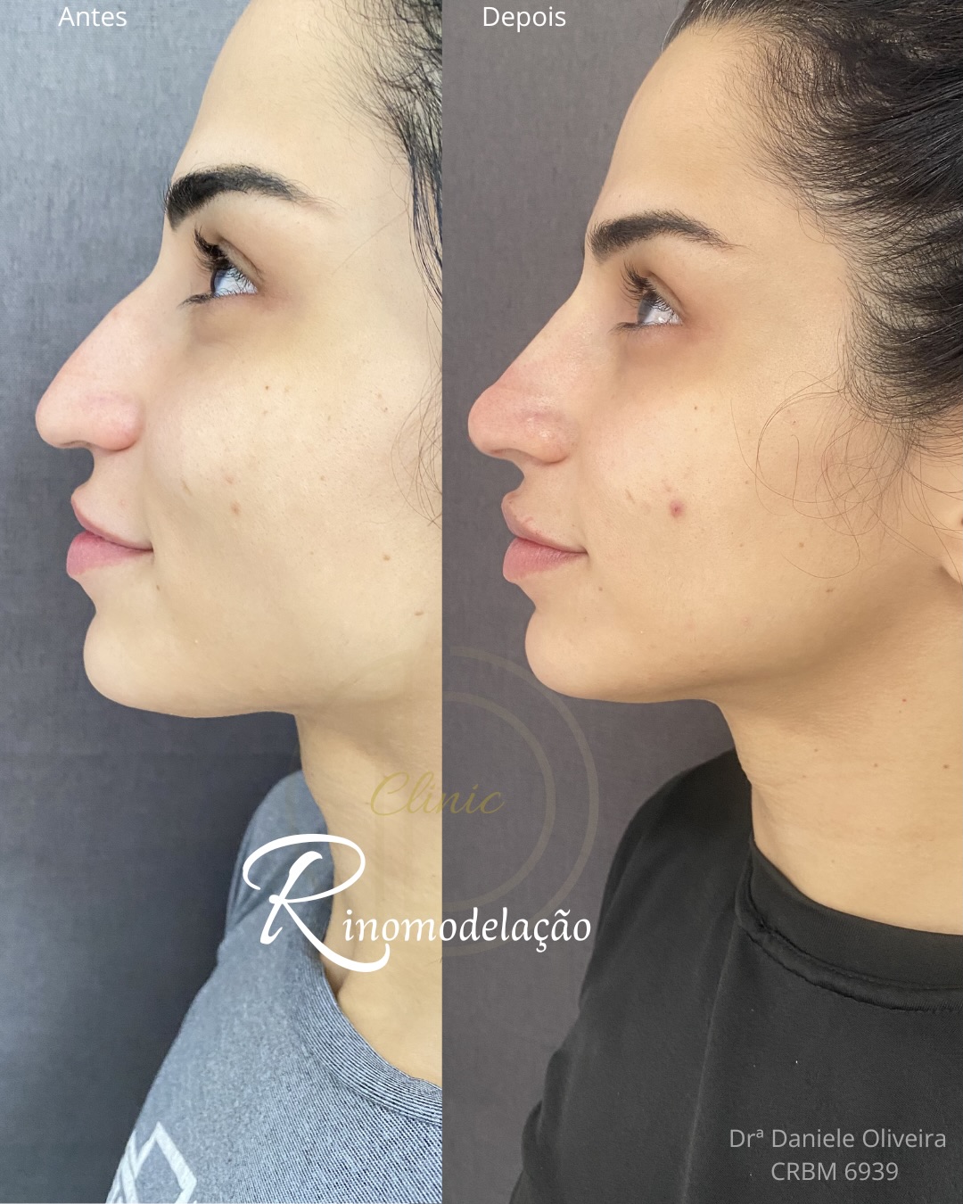 Antes e depois de paciente da Dra. Daniele