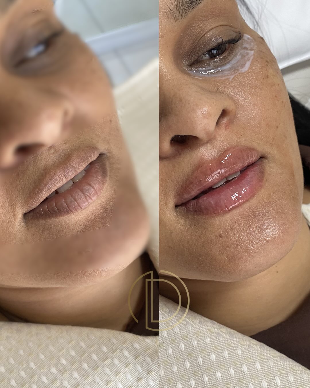 Antes e depois de paciente da Dra. Daniele