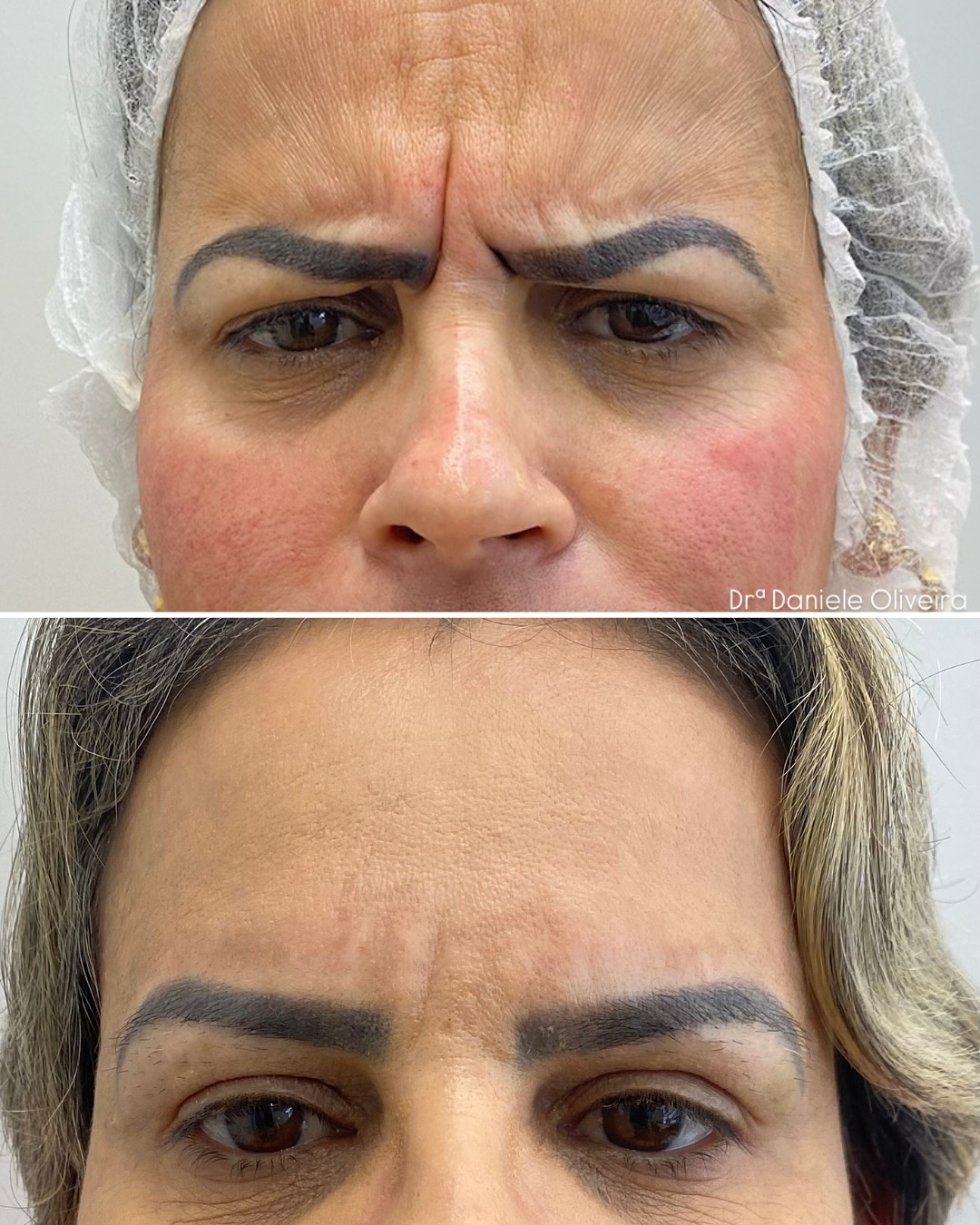 Antes e depois de paciente da Dra. Daniele