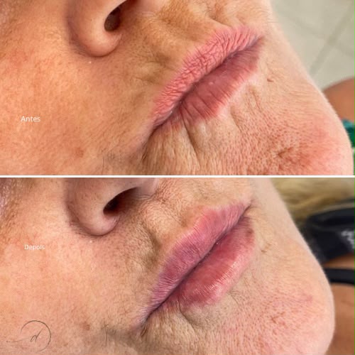 Antes e depois de paciente da Dra. Daniele